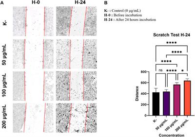 Caulerpa racemosa extract inhibits HeLa cancer cells migration by altering expression of epithelial-mesenchymal transition proteins